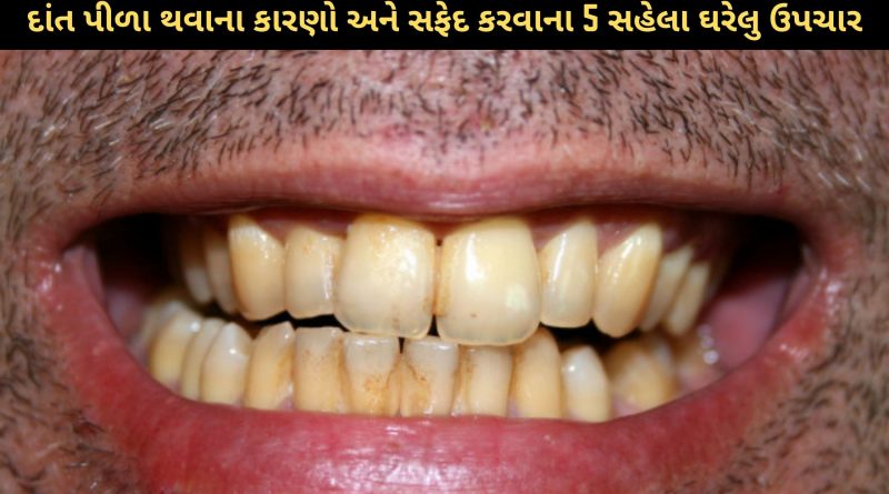 yellow teeth natural remedies