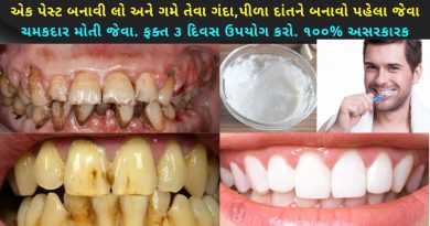 dant ne safed karava no upay