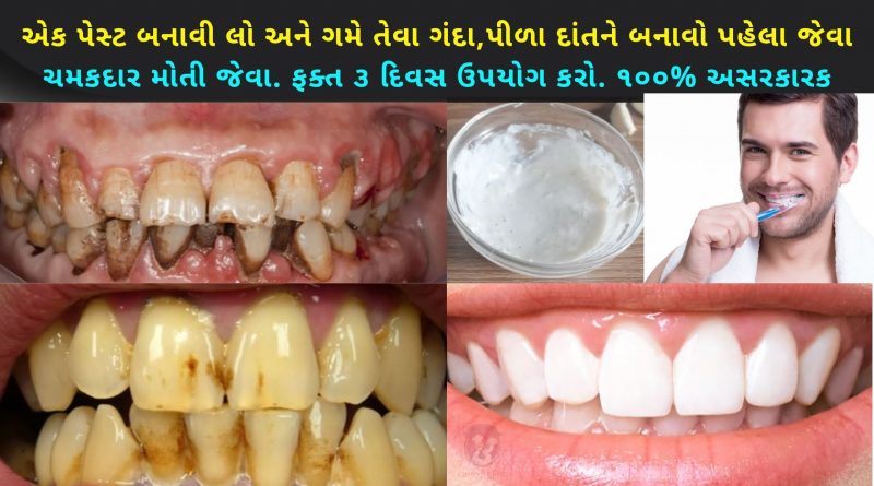 dant ne safed karava no upay