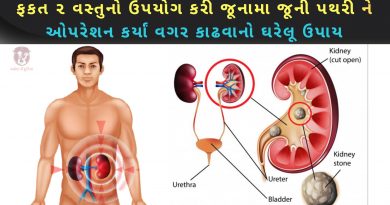pathari no desi upay in gujarati