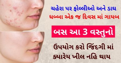 khil dur karvana upay