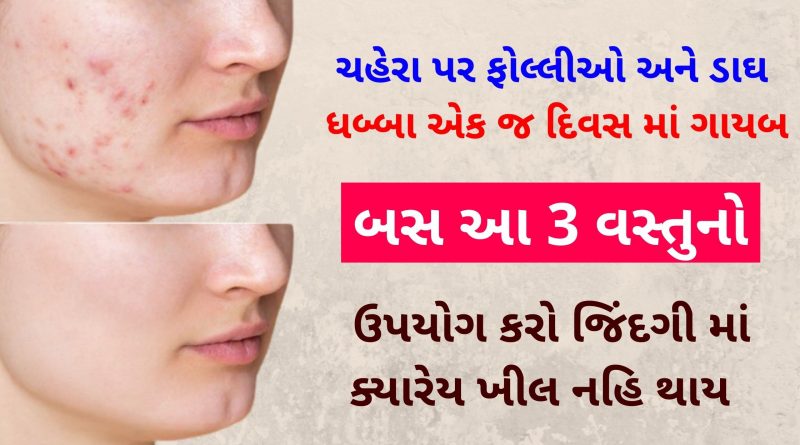 khil dur karvana upay