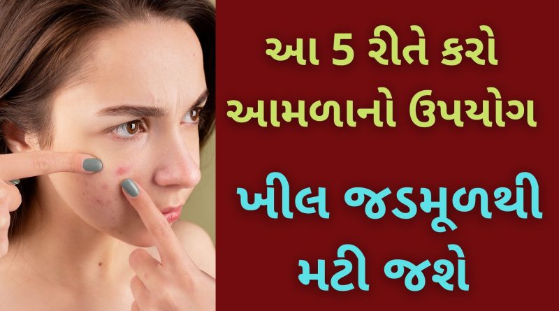 khil matadava ni dava