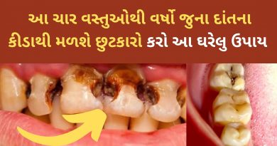 home remedies for tooth