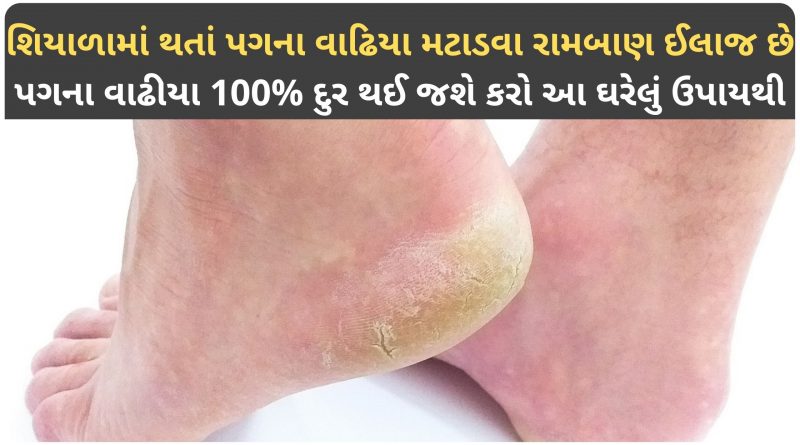 pag na vadhiya ni dava