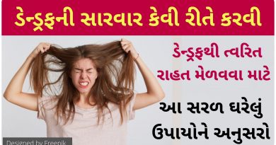 home remedies for dandruff