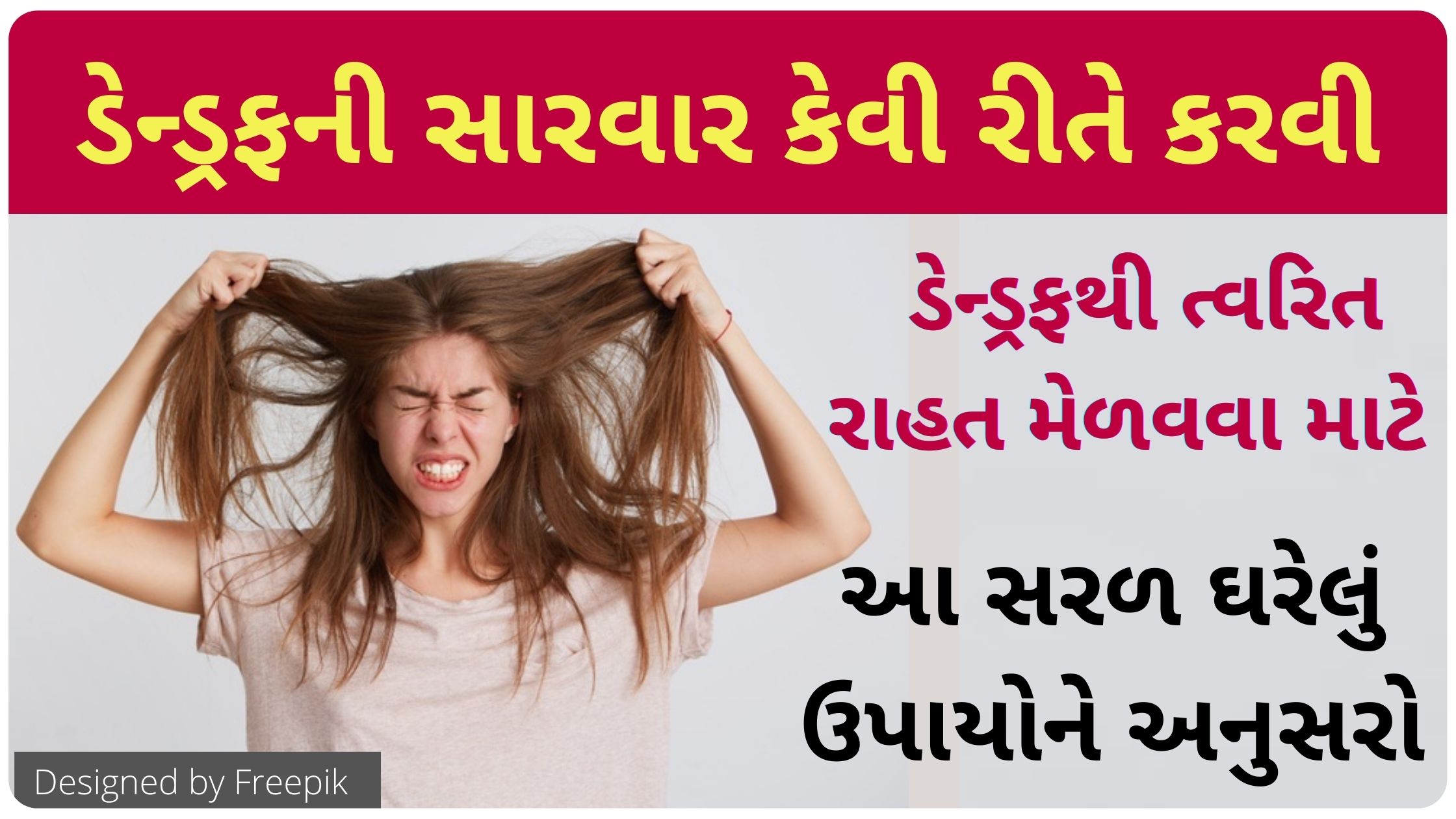 home remedies for dandruff