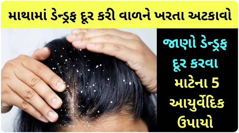 home remedies for dandruff in gujarati