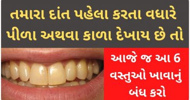 what food can make your teeth yellow