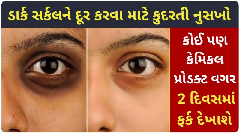 dark circles remedy at home in gujarati