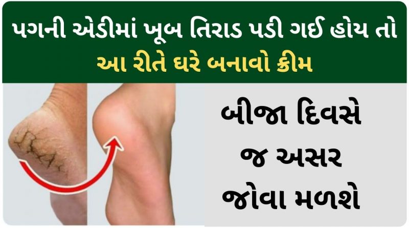 pag na vadhiya mate cream