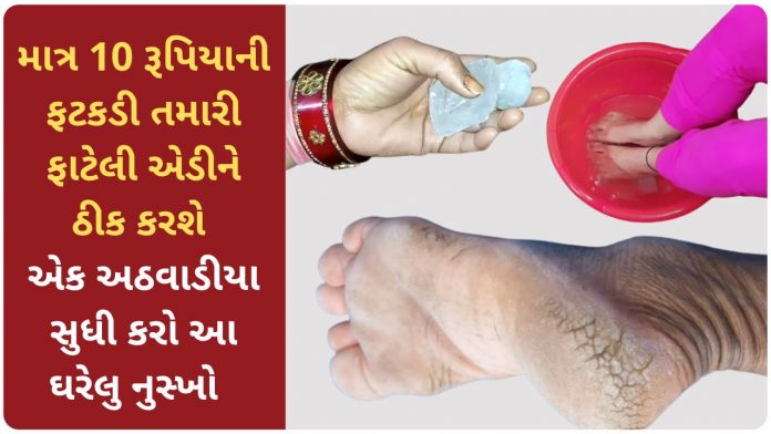 cracked heels home remedy in gujarati