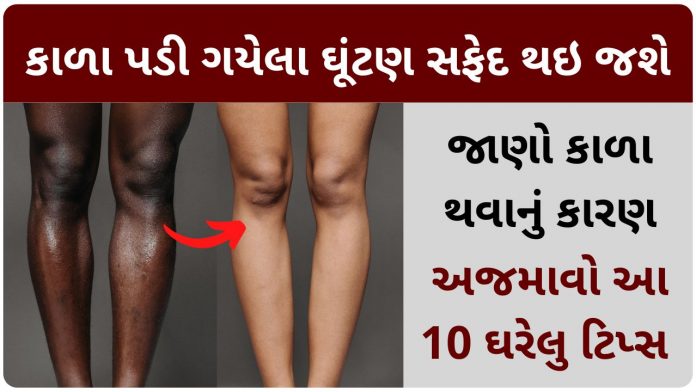 dark knees home remedies in gujarati