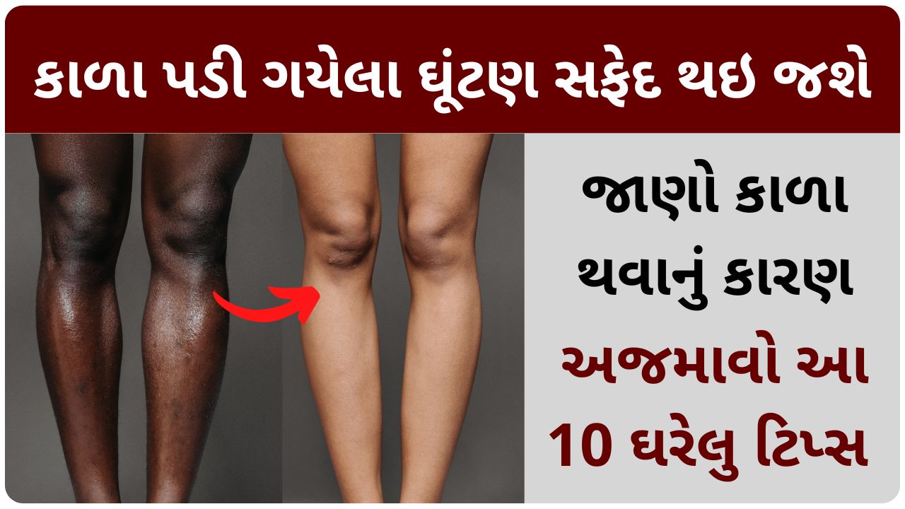 dark knees home remedies in gujarati
