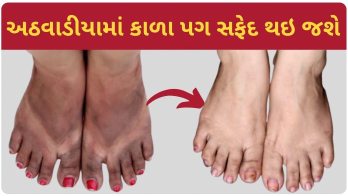 Home Remedies to Black Legs to white