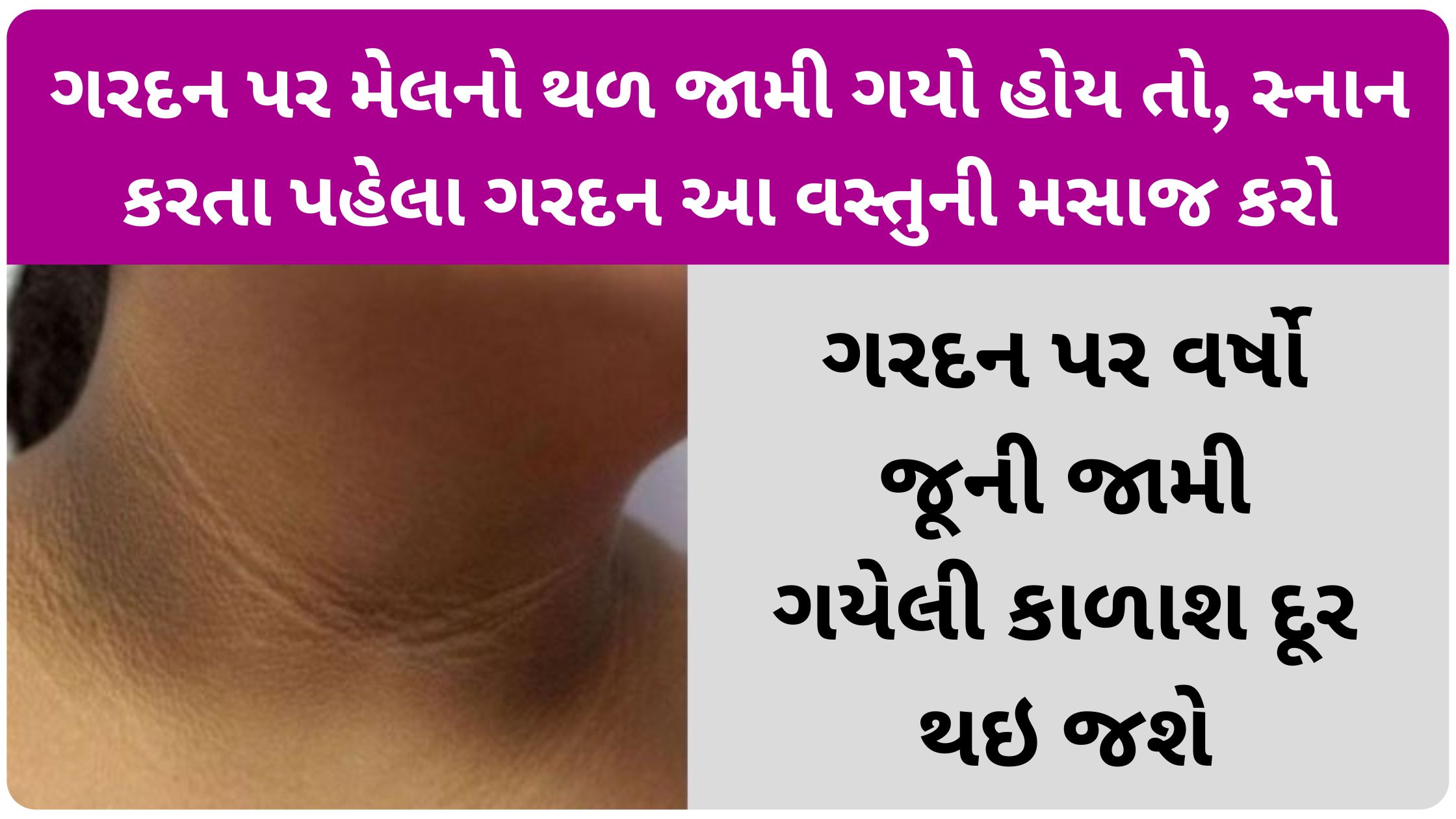 black neck removal home remedies in gujarati