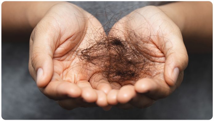 These mistakes can be behind hair loss