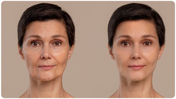 how to look young