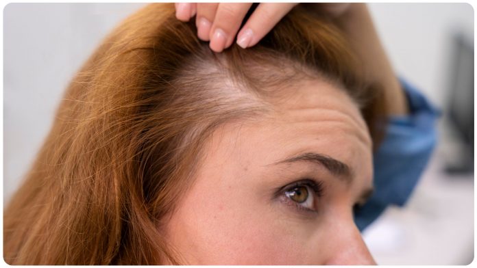 hair loss home remedies in gujarati