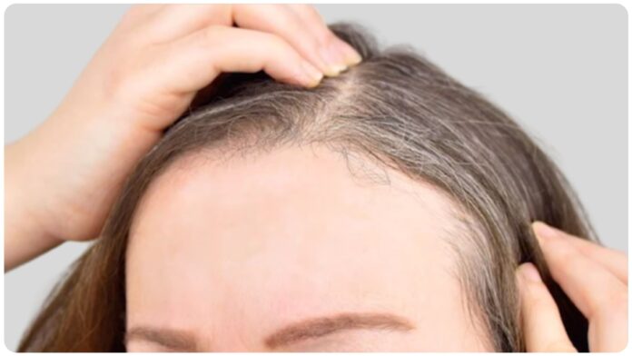 how to turn black hair to white naturally
