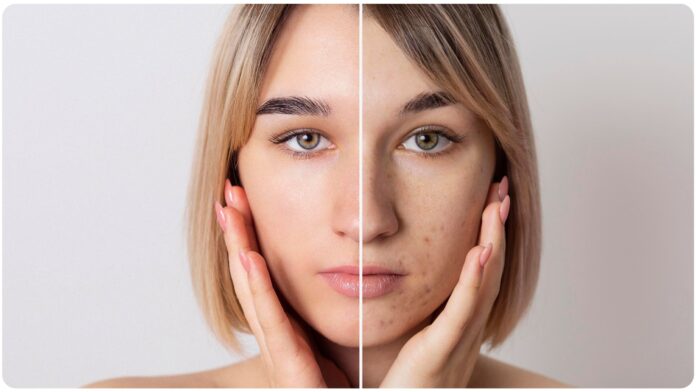 skin tanning removal home remedies in gujarati