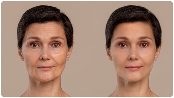 Potato face mask for loose skin