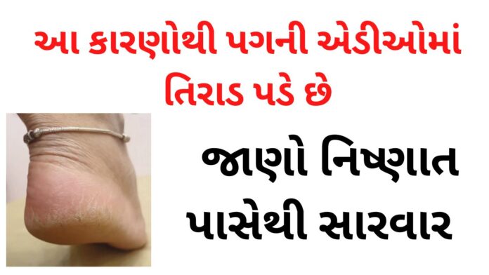 crack heels home remedies gujarati language
