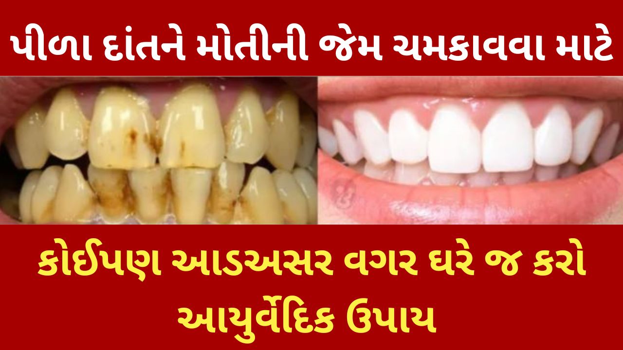 how to get rid of yellow teeth naturally at home