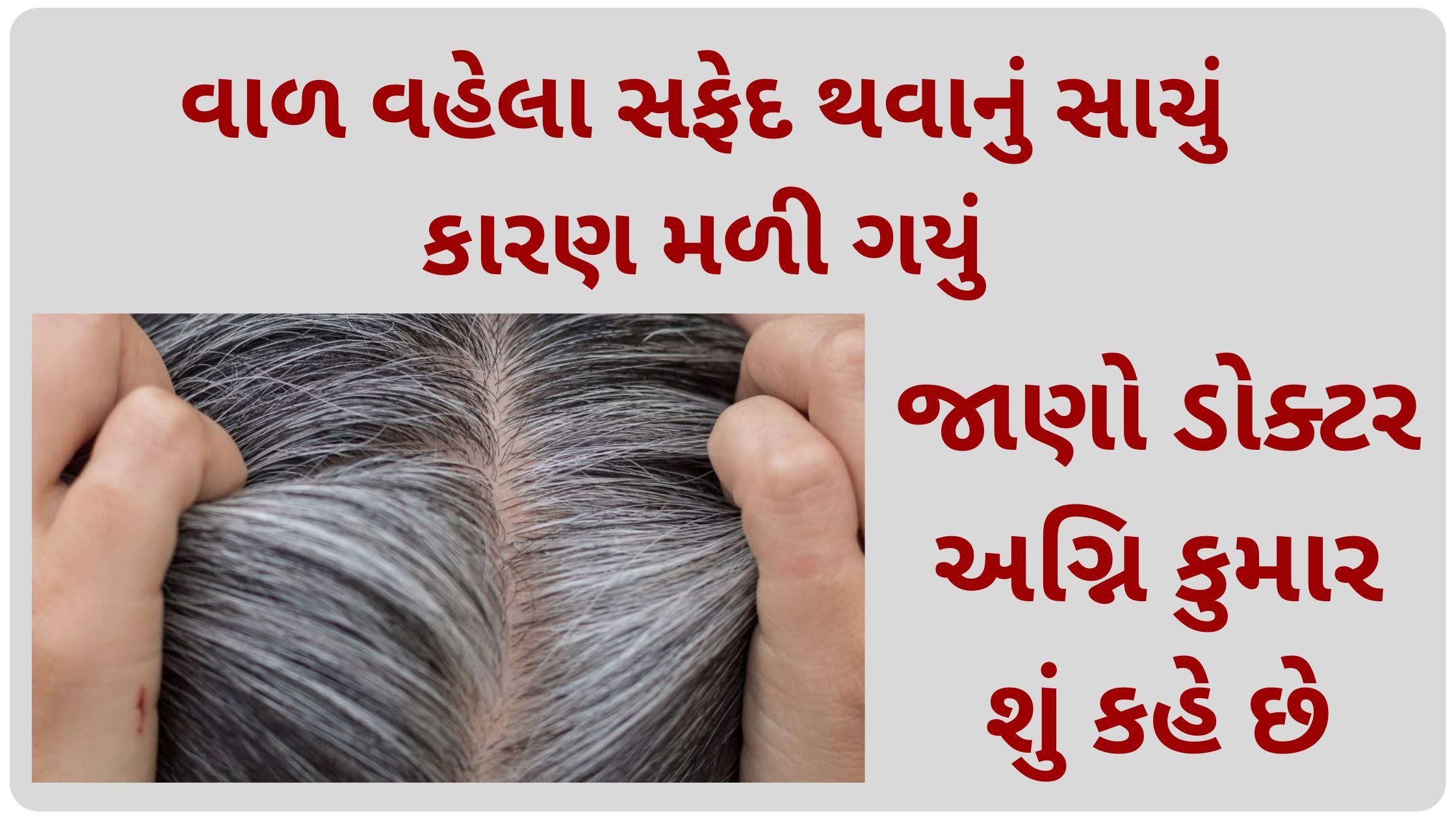 white hair at young age reason