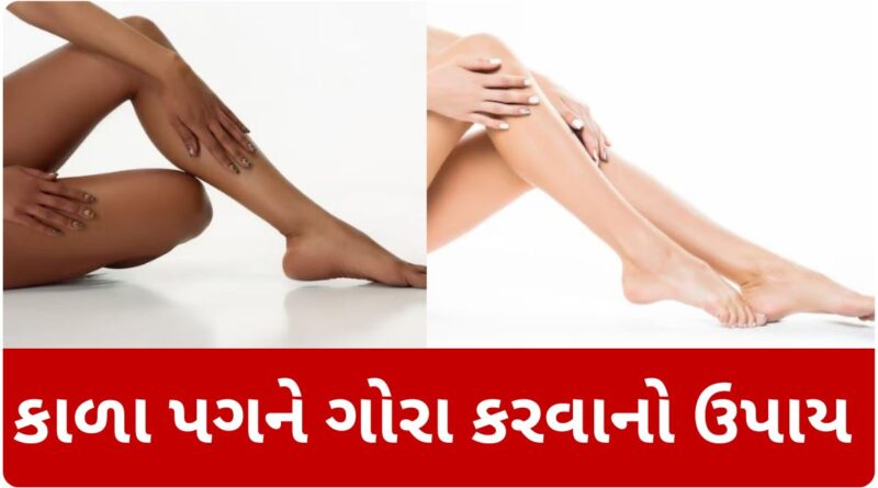 home remedy for dark feet